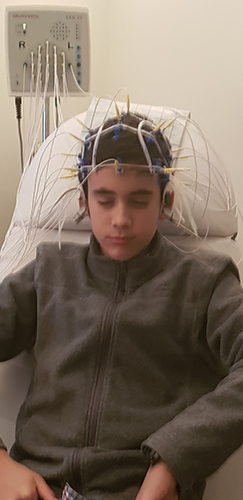 EEG-Ableitung